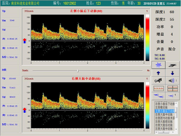 經顱多普勒雙通道,單深度界面 經顱多普勒雙通道,單深度界面