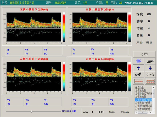 經顱多普勒單通道,四深度界面 經顱多普勒單通道,四深度界面