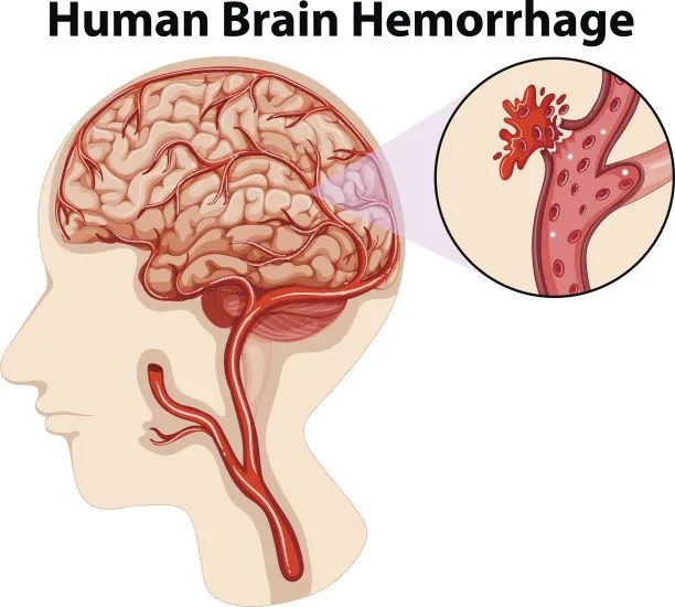 超聲經(jīng)顱多普勒(TCD)檢測儀該如何使用 超聲經(jīng)顱多普勒(TCD)檢測儀該如何使用