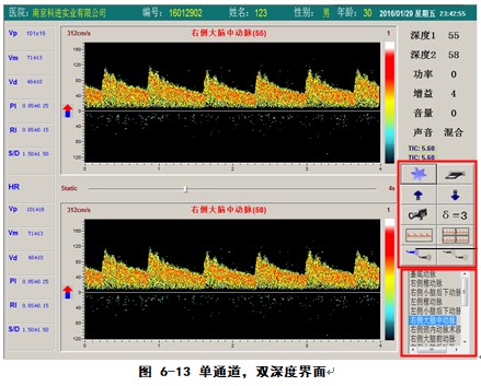 經顱多普勒軟件單通道雙深度檢測界面