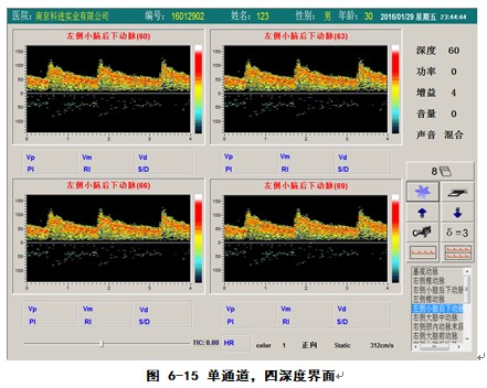 經顱多普勒軟件單通道四深度檢測界面